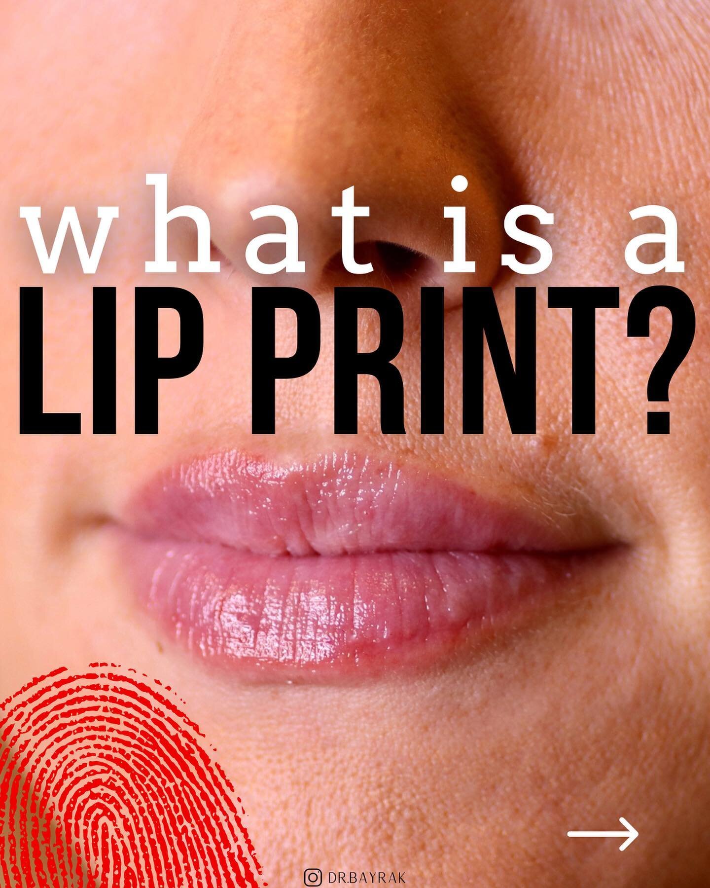 Lip prints, or &ldquo;sulci labiorum,&rdquo; refer to the patterns of grooves and fissures on the lip. These are similar to fingerprints, palm prints, and footprints, can be used as a positive means of identification (including in criminal investigat