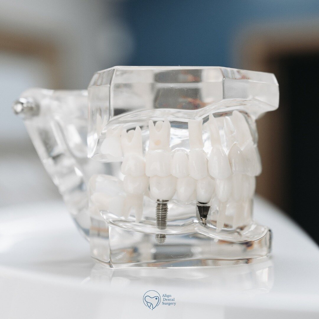 Bringing back smiles one implant at a time. 😄✨ ⁠
Dental implants aren't just about aesthetics; they're about reviving confidence and improving quality of life. If you're on the fence about dental restoration, remember, every smile is worth it.⁠
Say 