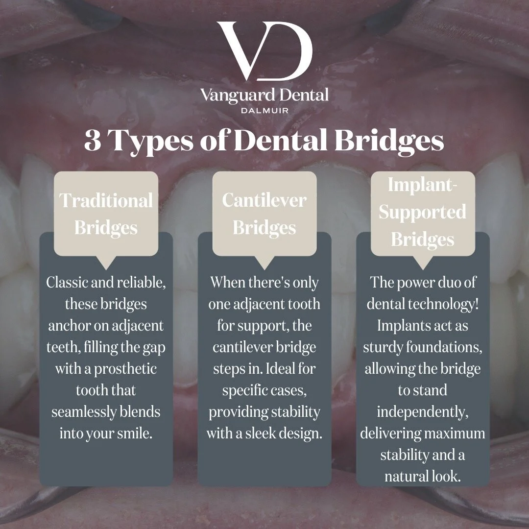 ✨ Bridging Brilliance: Explore Dental Bridges at Vanguard Dental! 🌉

Traditional Bridges:
Classic and reliable, these bridges anchor on adjacent teeth, seamlessly filling the gap with a prosthetic tooth that becomes a natural part of your radiant sm