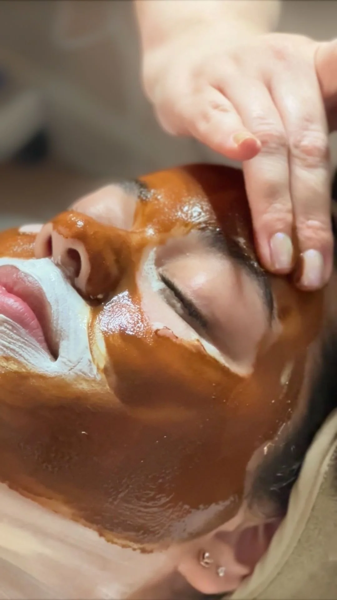 A person receiving a facial treatment with a brown facial mask applied and a white cream on lips, while a practitioner massages their face.