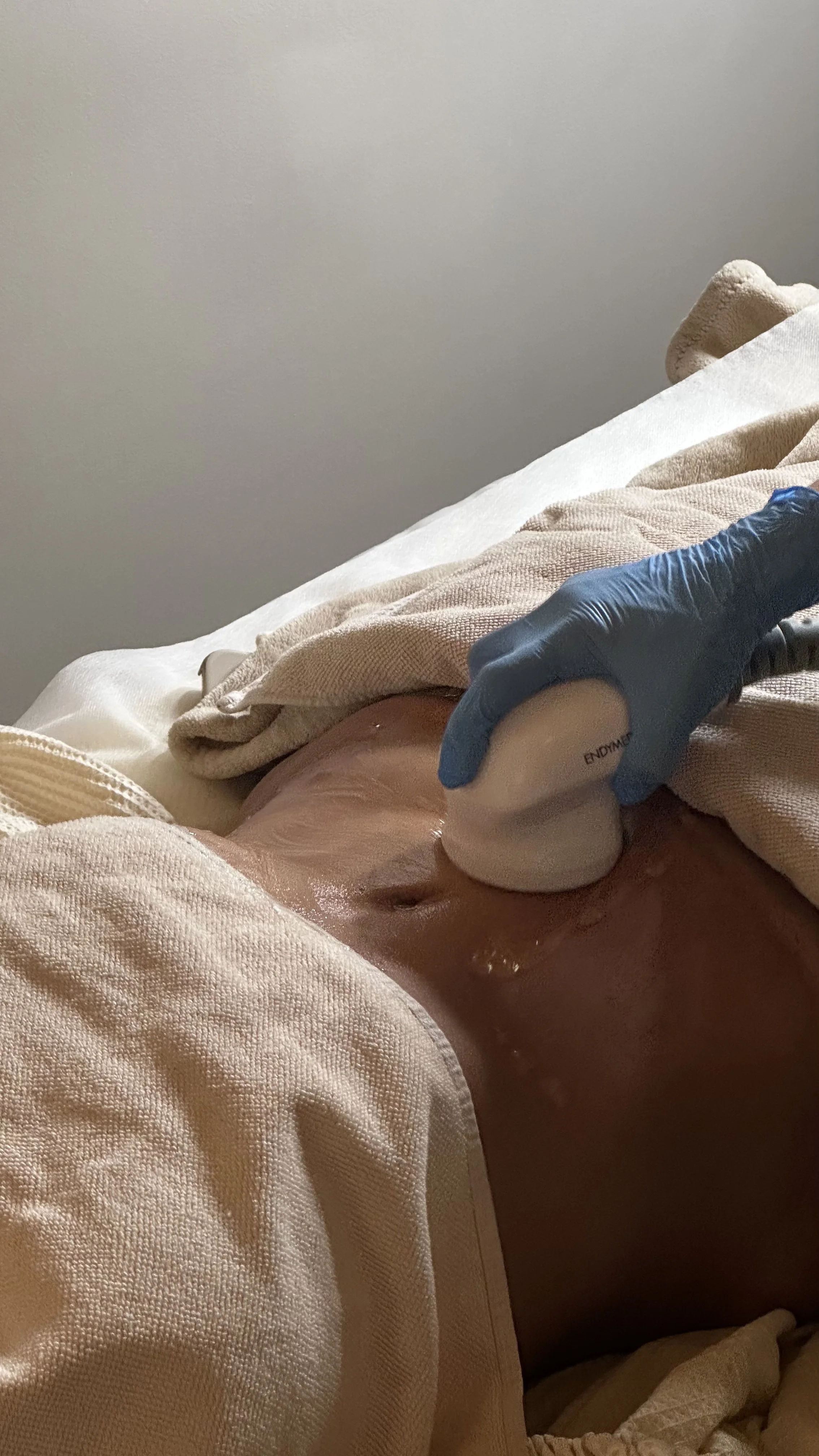 A close-up of a person undergoing an ultrasound procedure on their abdomen, with a medical professional wearing blue gloves holding the ultrasound probe on the patient's stomach.