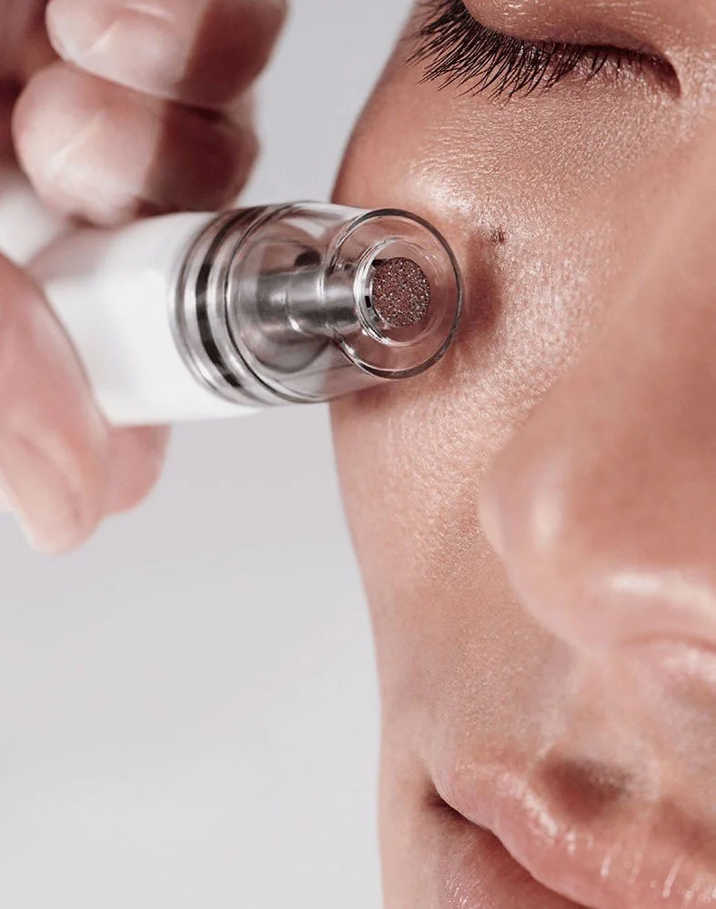 Close-up of a person applying a skincare or cosmetic treatment with a small device near their cheek.