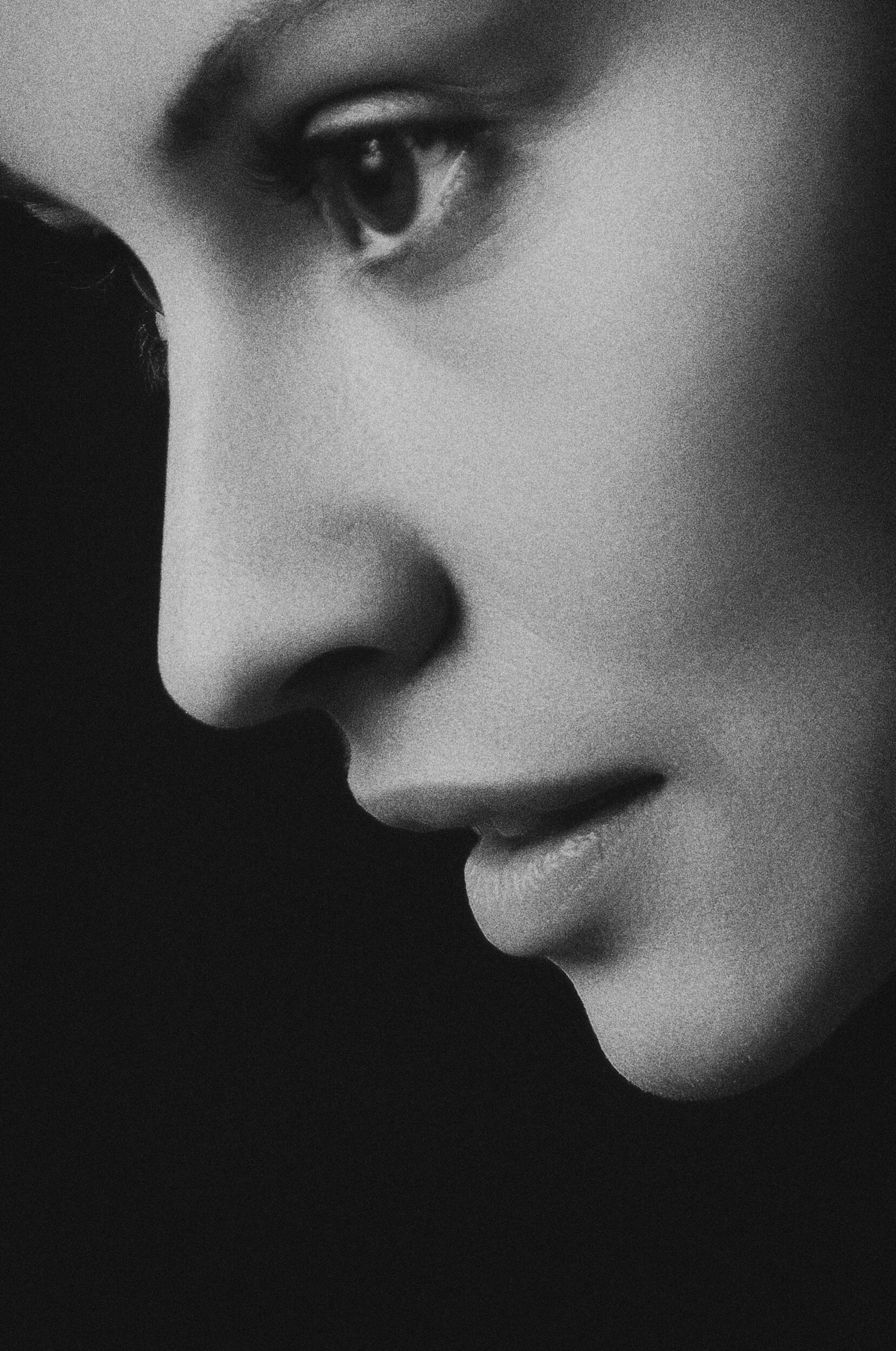 Rejuvenate and Illuminate: The Carbon Laser Peel Experience in Barnes, London