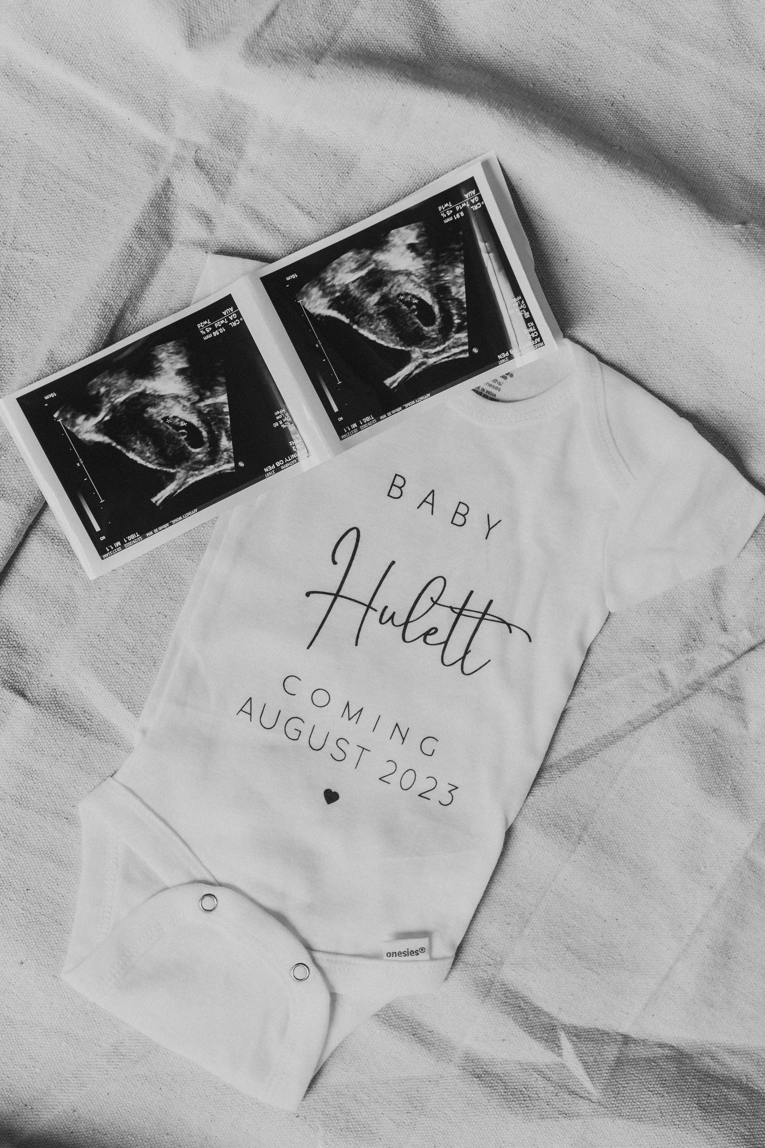  pregnancy announcement photography—a sonogram photo and a onesie lay together on a canvas dropcloth 
