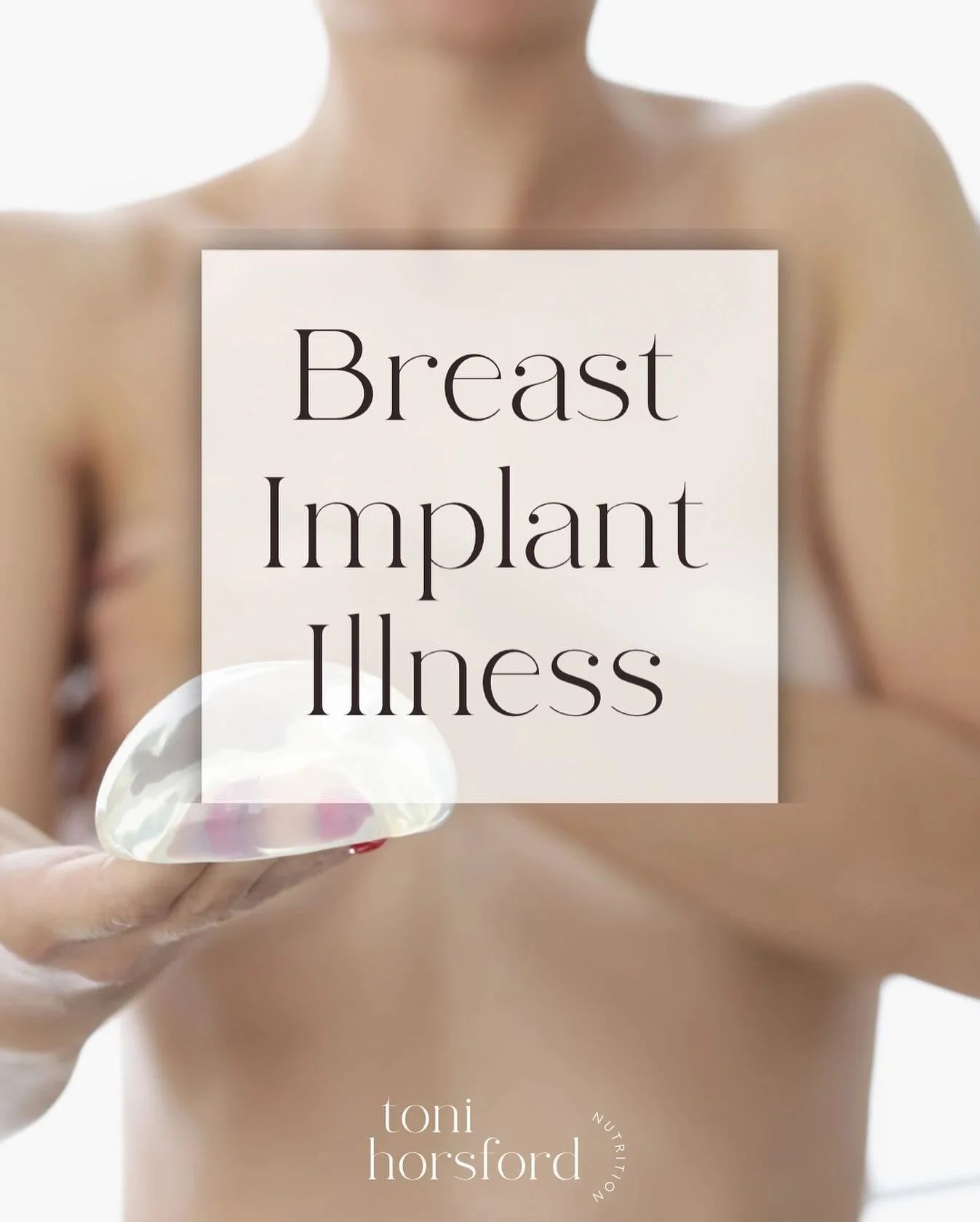 Breast implant illness (BII) is a term used to describe a range of symptoms that some individuals with breast implants experience. These symptoms can include chronic fatigue, joint and muscle pain, cognitive difficulties, headaches, hair loss, dry ey