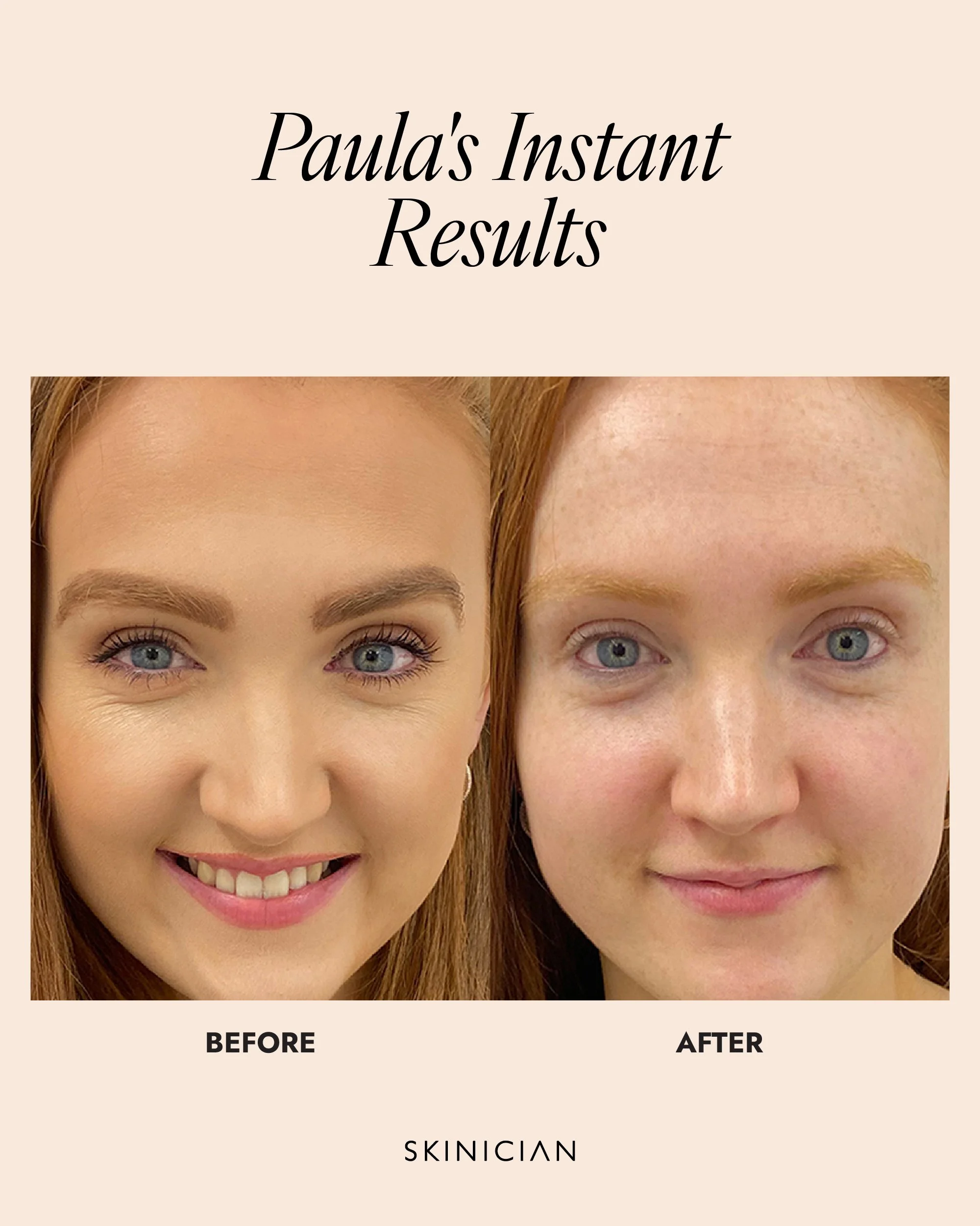 Skinician-Results_Cleansing Balm.jpg