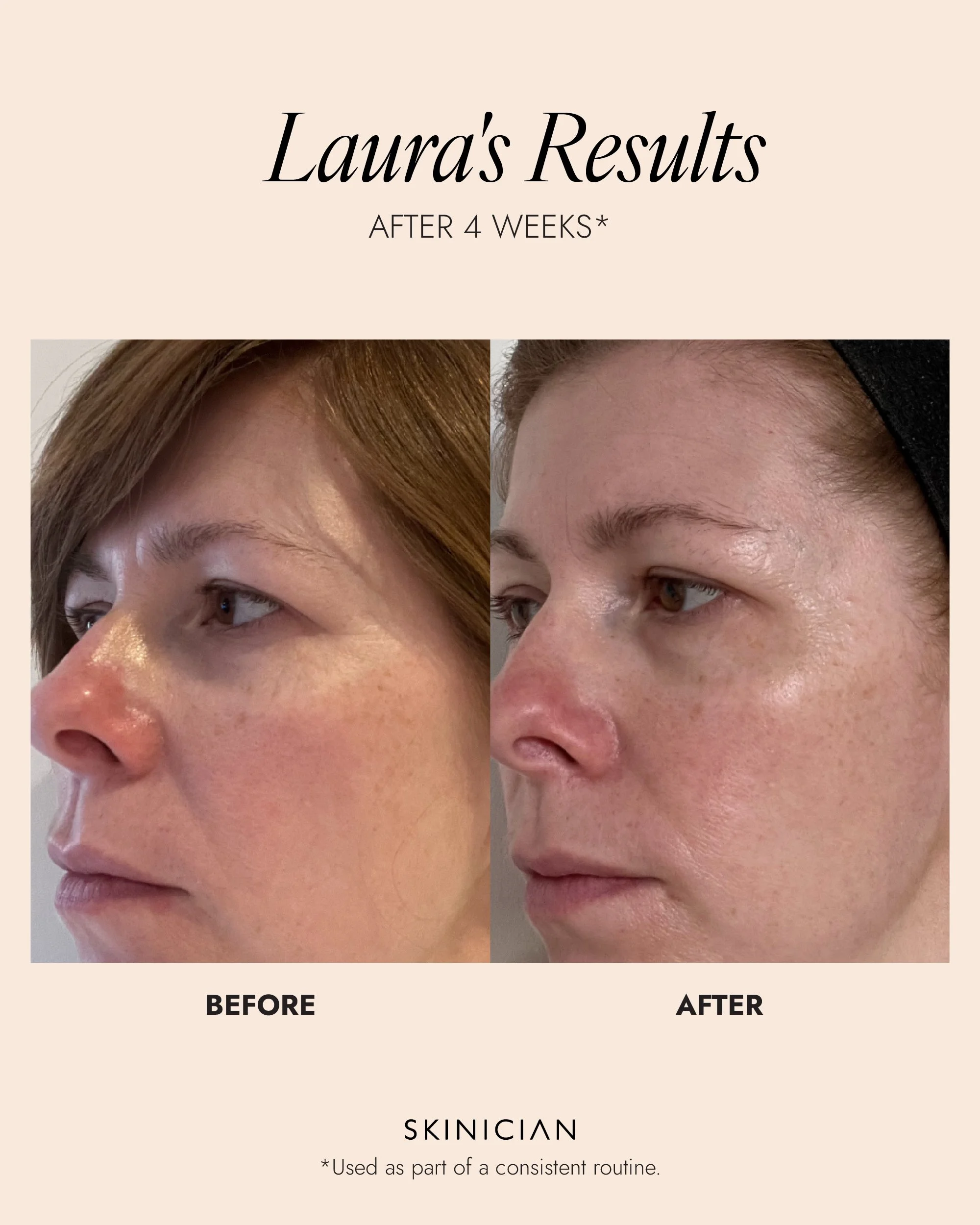 Skinician-Results_Retinol Powerbalm.jpg