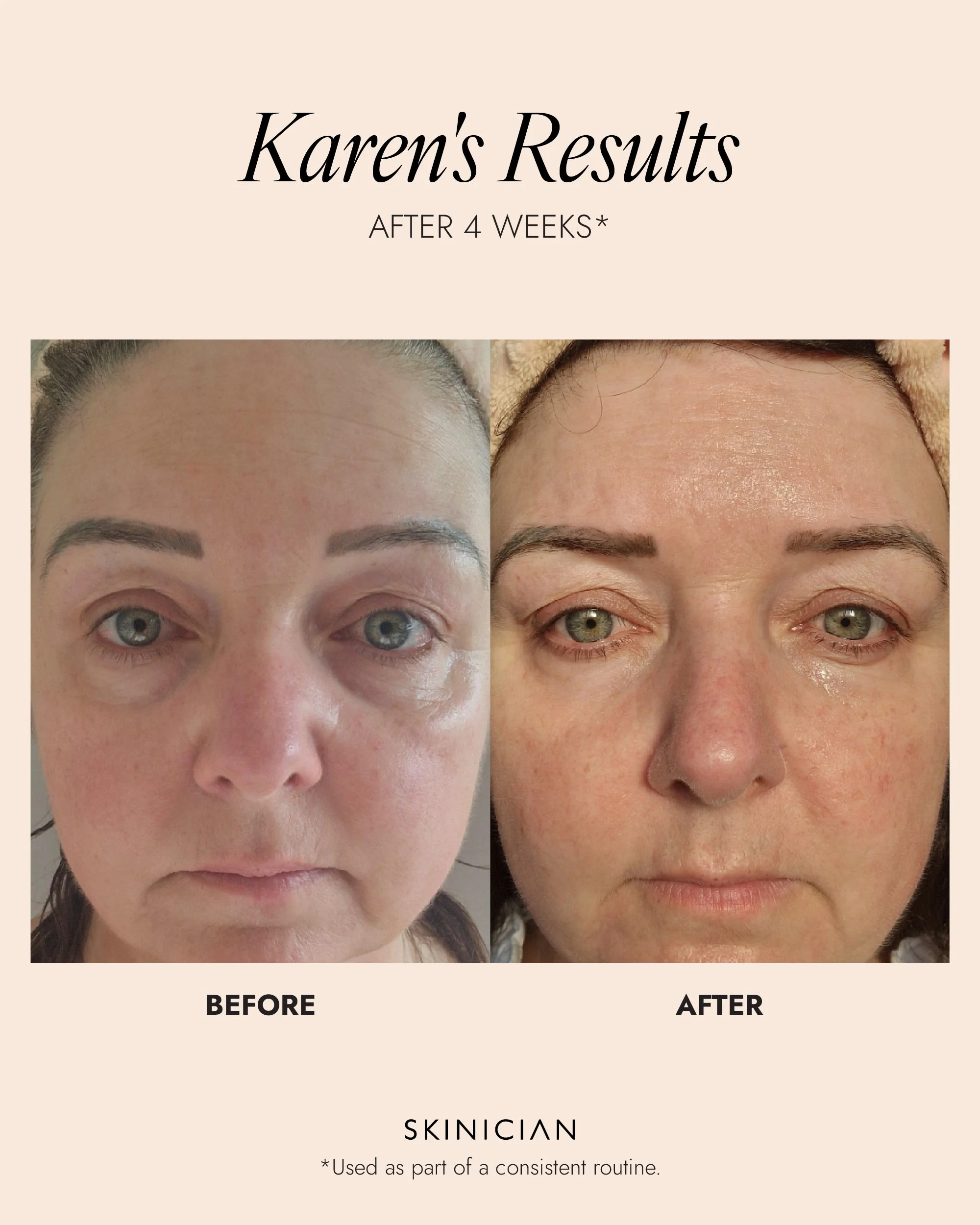 Skinician-Results_Peptide Eye Complex.jpg