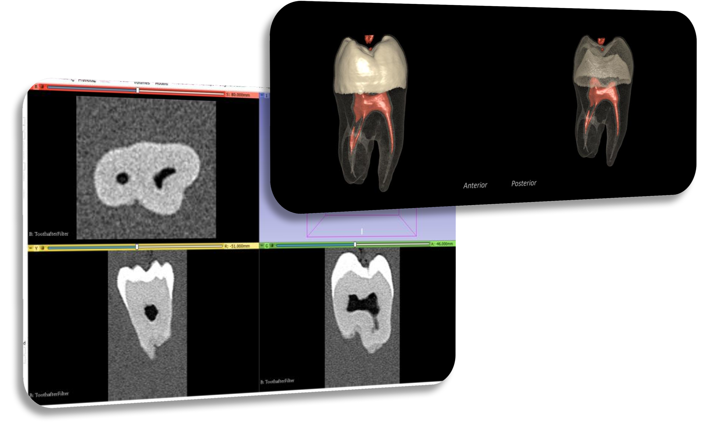 CT Scan Segment