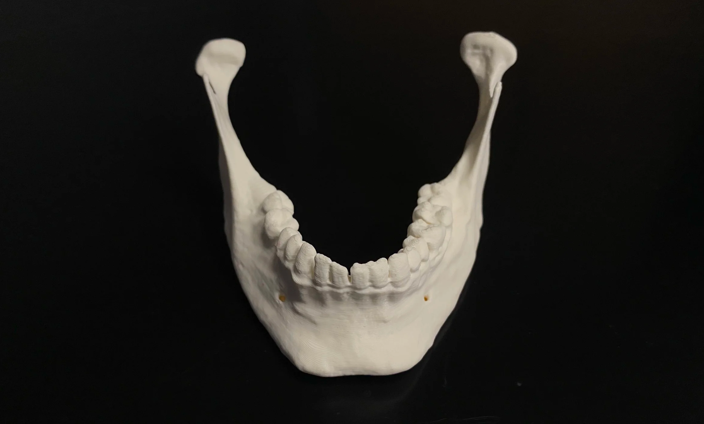 Mandible - CT 3D Reconstruction - 3D Printing