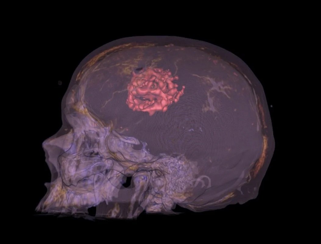 Brain-Direct-CT-PET-all2 - Copy.jpg