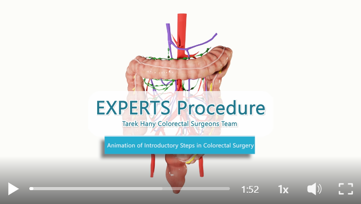 LTHTR: EXPERTS Procedure - animation & video edit