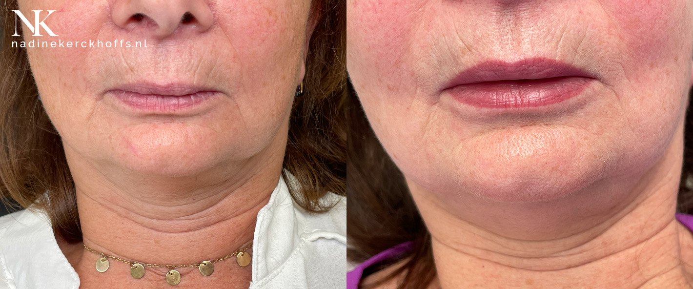 Lippen / lippigmentatie door Nadine Kerckhoffs Permanente Make-up