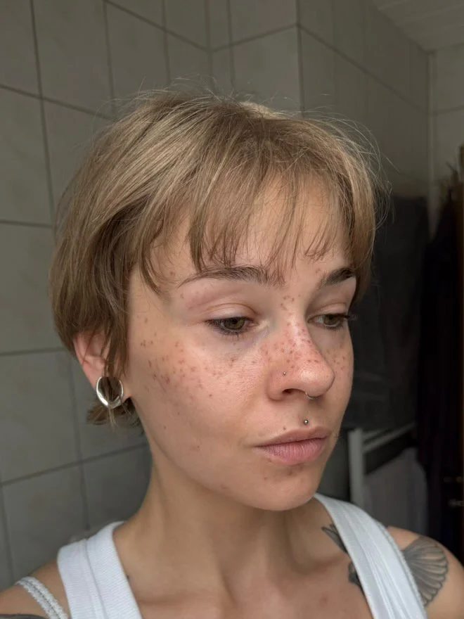 Packet M - Second Day