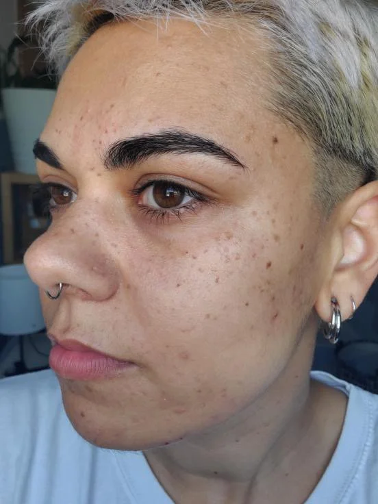 Packet M - Settled after a week