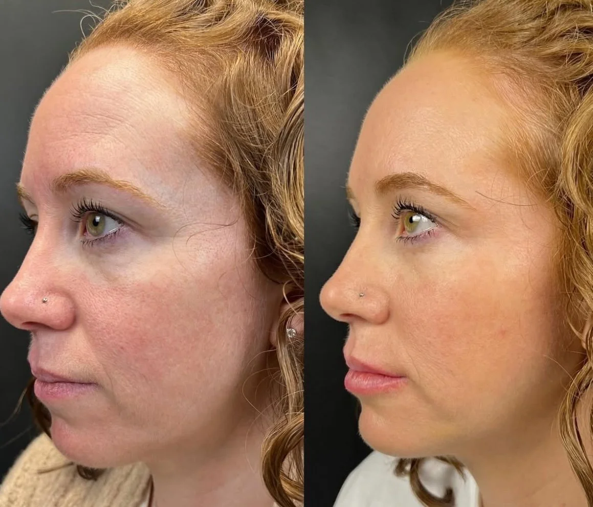 Brooke full face 2.jpg