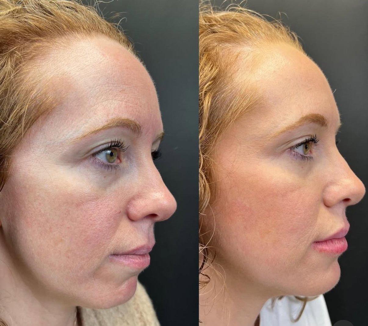 Brooke full face 3.jpg