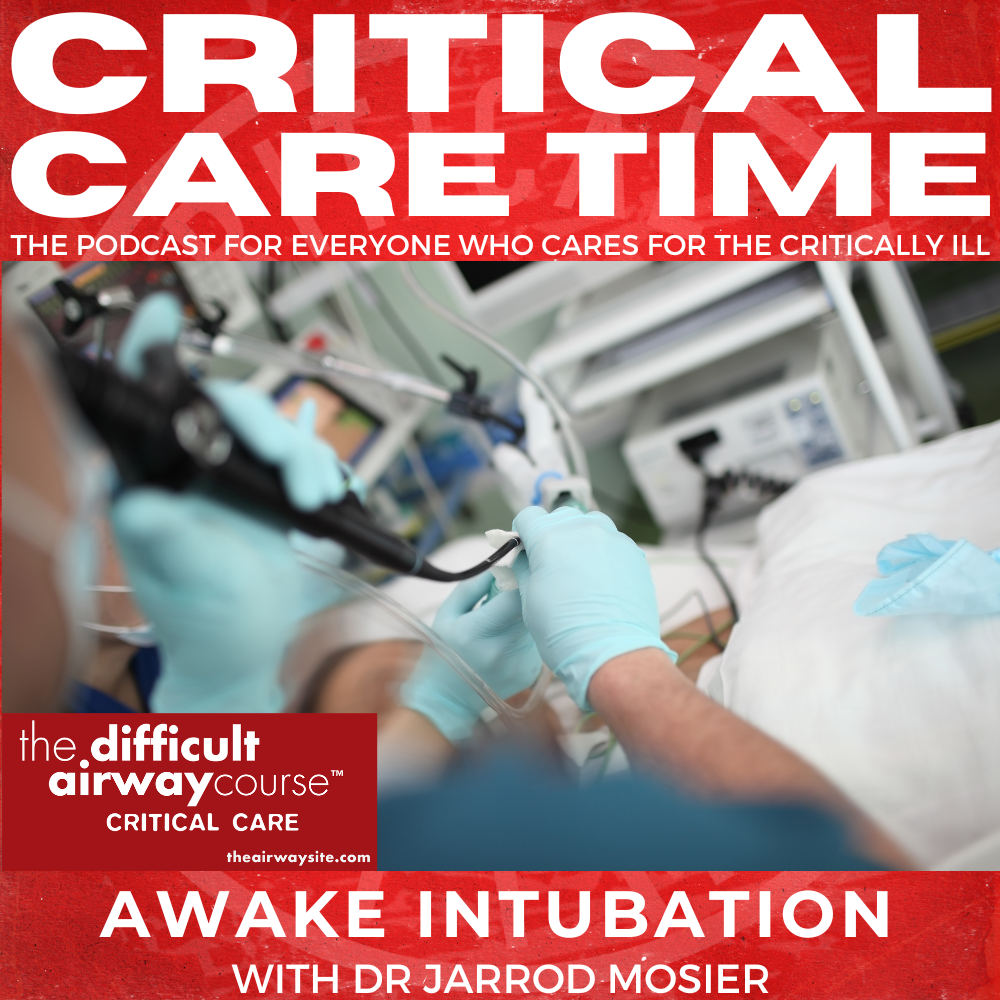 #81 Awake Intubation