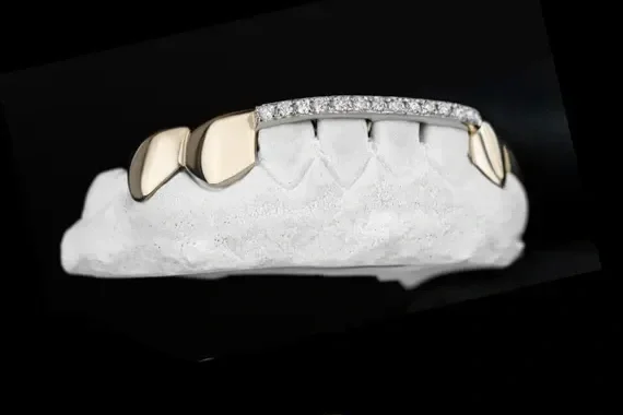 Close-up of a gold and diamond dental jewelry piece displayed on a dental cast.