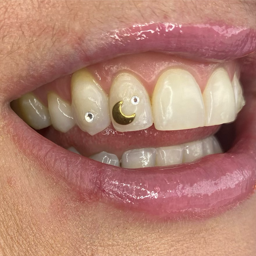 Close-up of a person's mouth showing upper teeth with decorative dental jewelry on two teeth, including a gold crescent moon and small rhinestones, and lips with gloss.