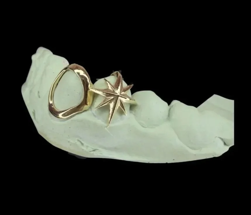 10k gold custom grillz portland icy fangs