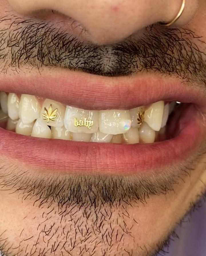 custom gold tooth gem by Icy Fangs