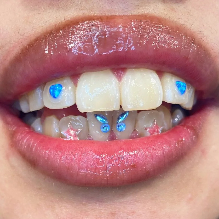 Close-up of a person's open mouth showing decorated teeth with blue heart-shaped and star-shaped stickers and rhinestones.