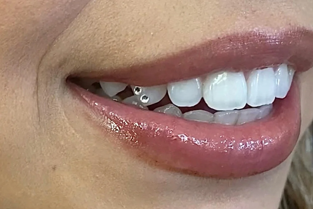 Close-up of a smiling person's mouth showing white teeth, pink lips, and metallic dental piercings on upper gums.
