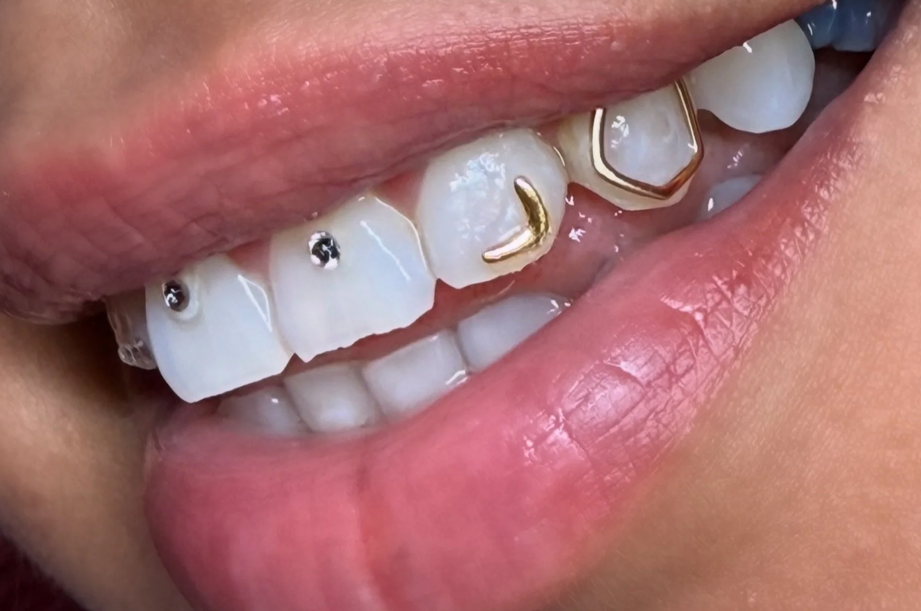 Gold and crystal tooth gems from Icy Fangs in Portland, OR