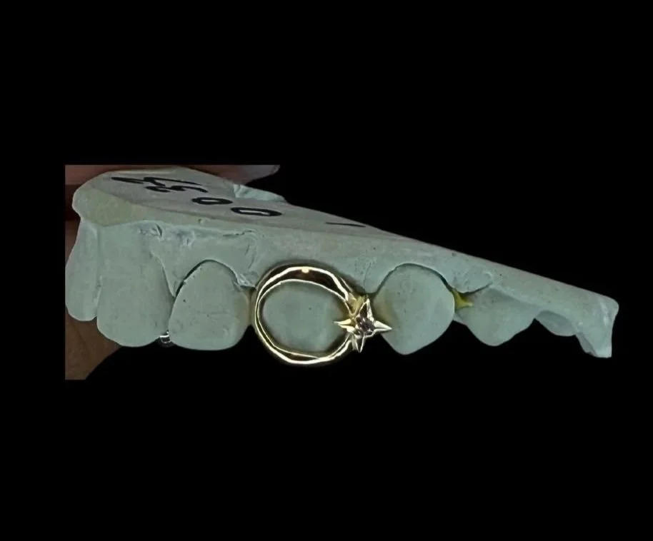 10k custom grillz in portland, OR. star and window grillz