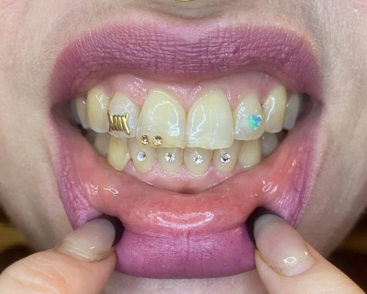 Tooth gem inspo with assorted crystals and 18k yellow gold and opal