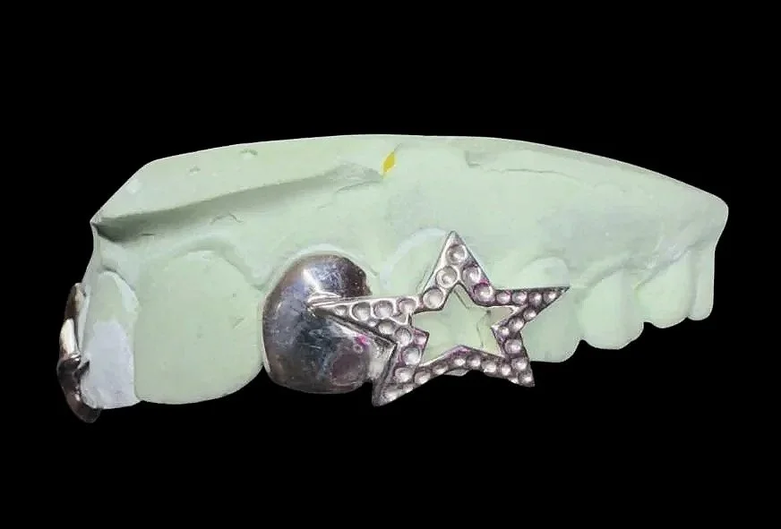 Custom silver grillz in portland, OR. Star and window grillz