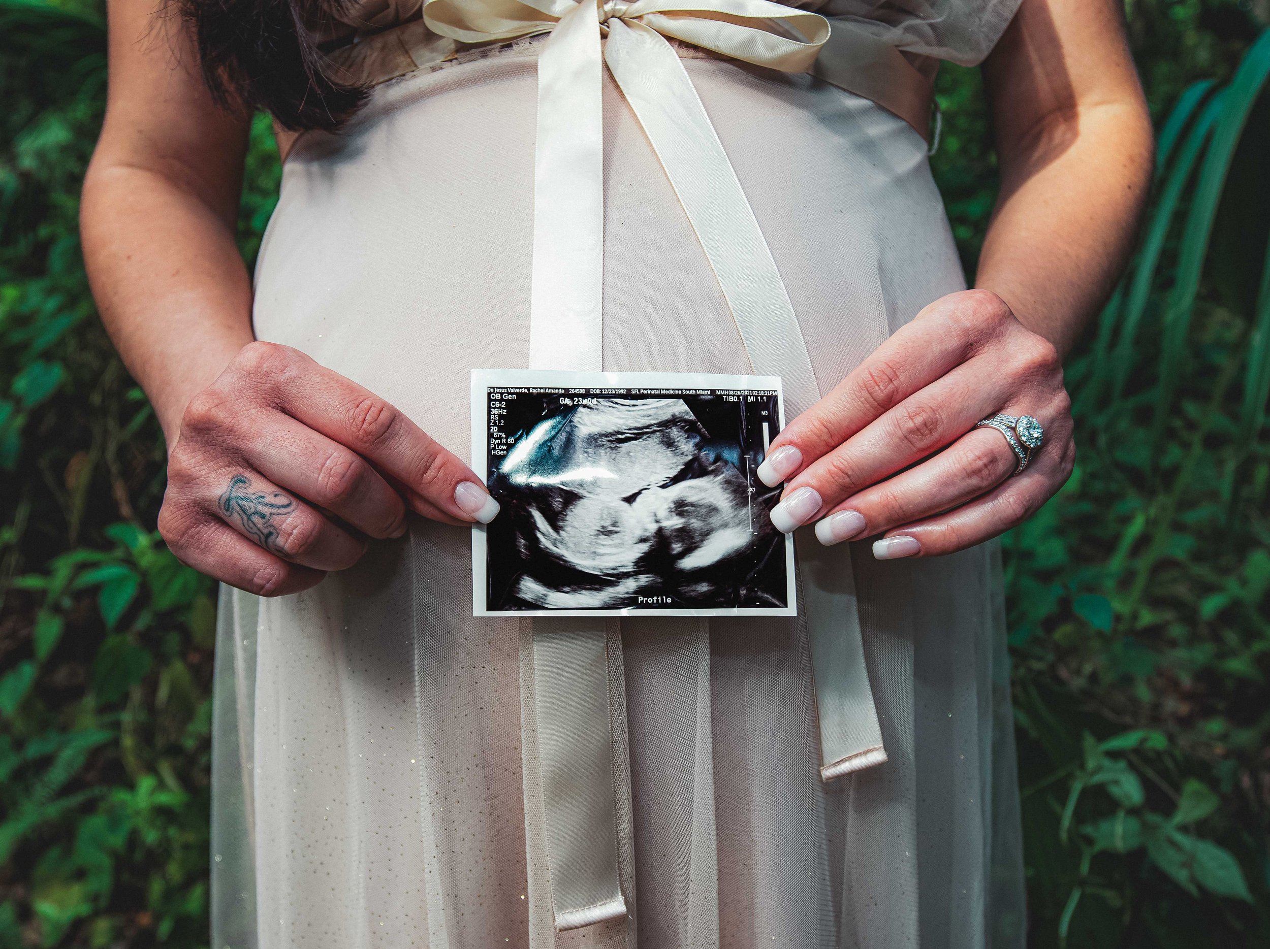 Miami-Maternity-Photoshoot-Bright-City-Studios-5.jpg