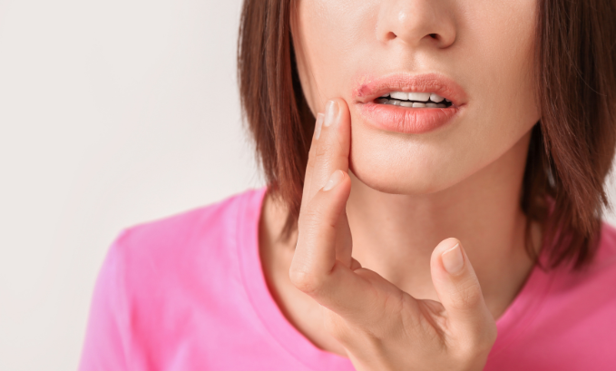 does red light therapy help cold sores