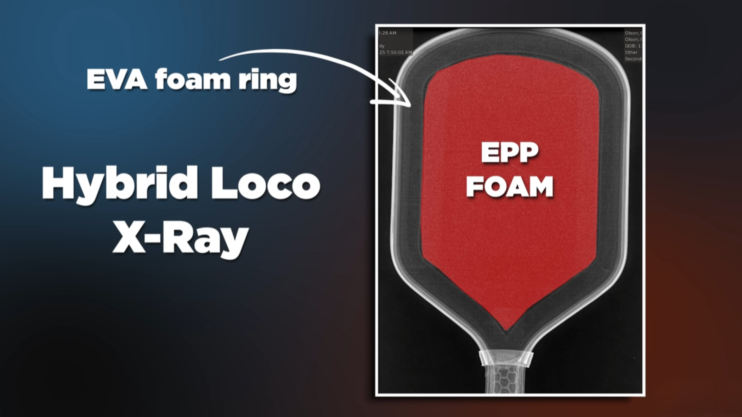 X-ray diagram of Bread & Butter Loco pickleball paddle showing hybrid EPP foam core with EVA foam ring around the edge