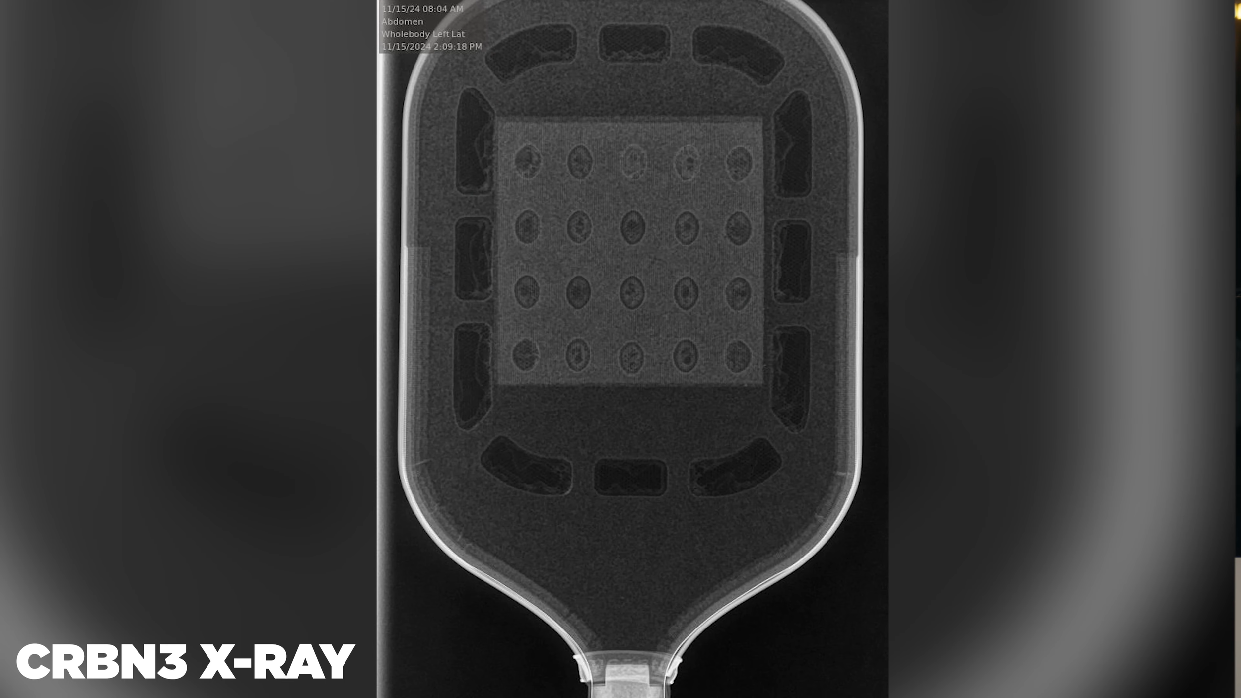 X-ray image of CRBN3 pickleball paddle revealing internal foam core structure with fiberglass patch in center