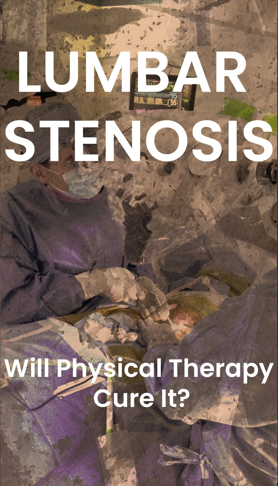 Lumbar Stenosis: Will Physical Therapy Cure it?