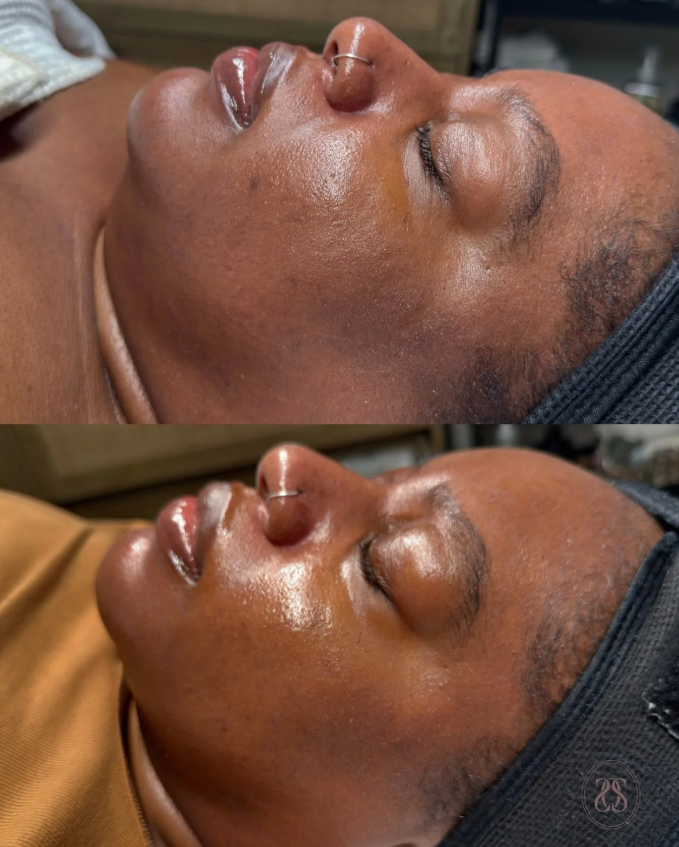 Fresh, bright, &amp; deeply hydrated.

This is what happens when your skin is treated with intention &amp; expertise , not overworked, not stripped, just balanced &amp; glowing.

Your skin deserves this level of care. 🤎✨ My beautiful client is using