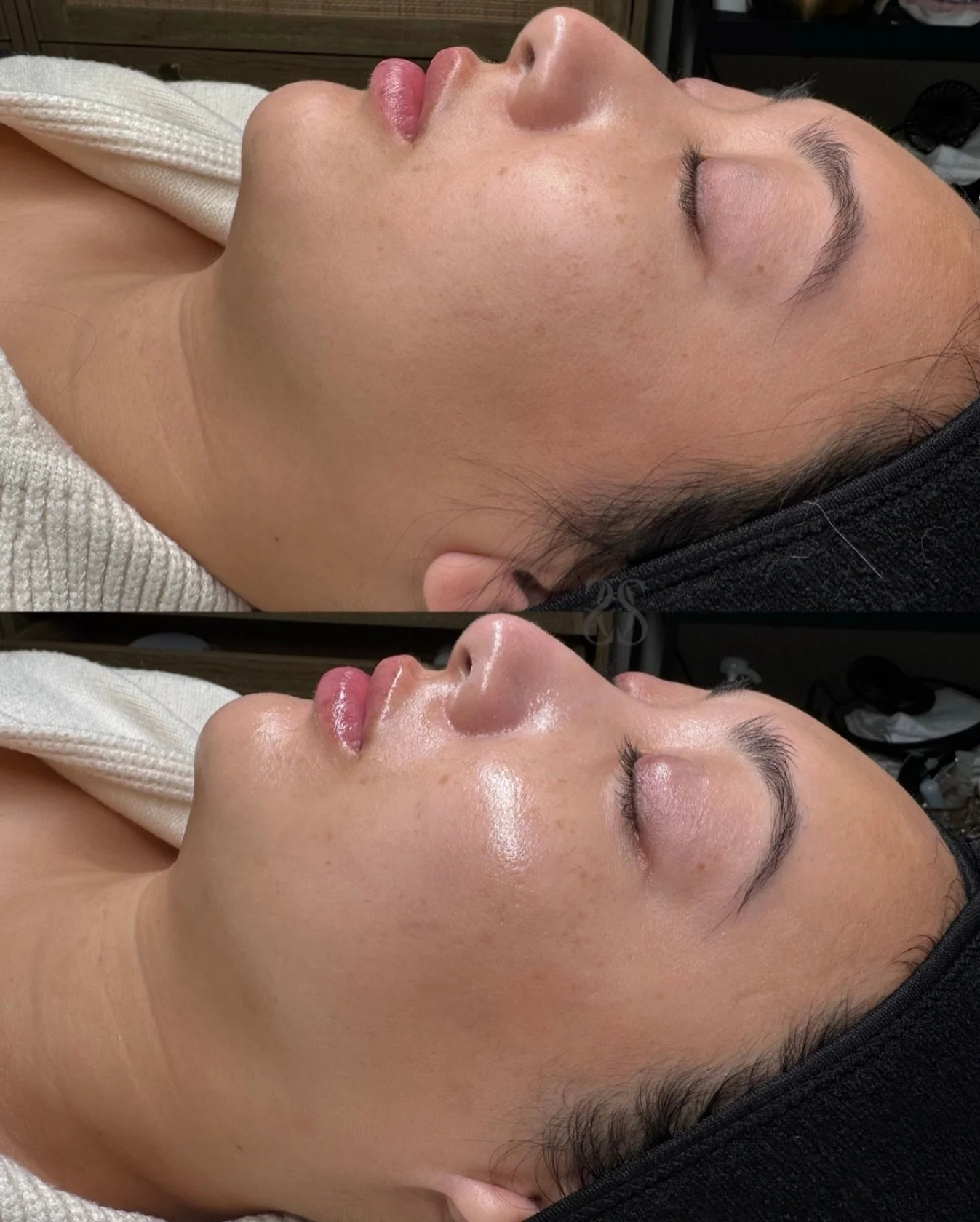 Dull skin WHERE? ✨✨✨ not here! 

Hydrafacial is that girl, to revive dull, dry, dehydrated winter skin! ❄️ January is the perfect time to book your skin reset! 

New here? WELCOME! 🤗 My name is Alisia, I&rsquo;m the founder of @shadesofskin.beautyba