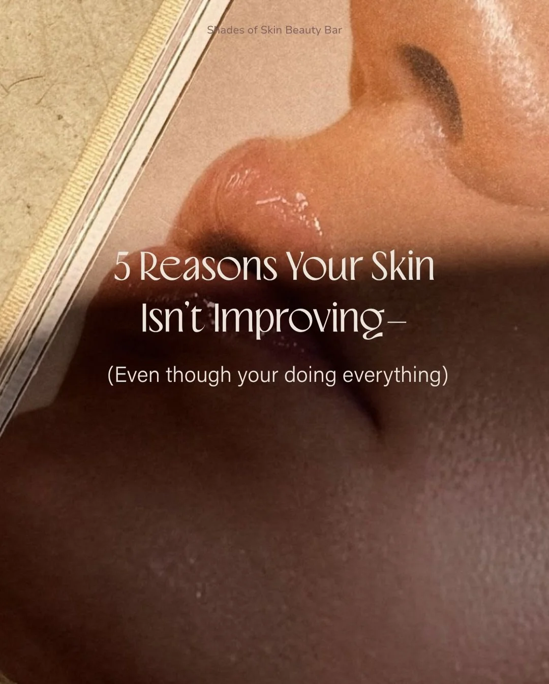 Your skincare routine isn&rsquo;t the problem &amp; you don&rsquo;t need another new product! 

The inconsistency is what&rsquo;s setting you back from clear skin. 

Getting a facial every few months won&rsquo;t fix:
&bull; acne
&bull; congestion
&bu