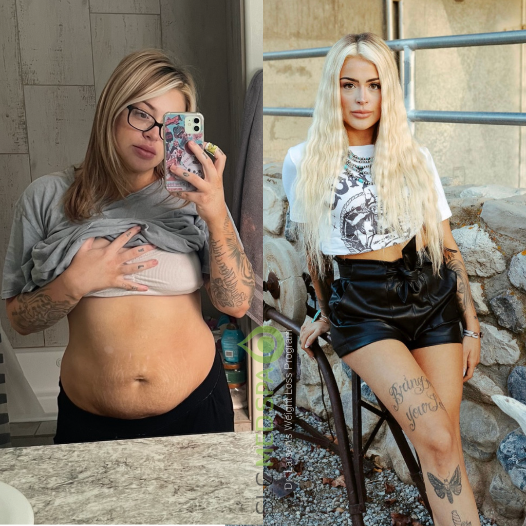 Before and After Vertical.png