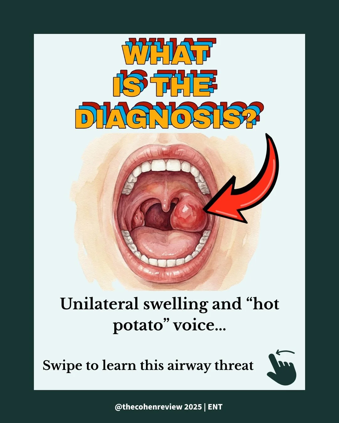 🚨 Board Exam Buzz: Peritonsillar Abscess! 🚨
Don&rsquo;t let this infection surprise you on the exam! A PTA is an abscess (pus pocket) near the tonsil, often a complication of tonsillitis or strep throat.

🎯 High-Yield Clinical Pearls:
* Classic Pr