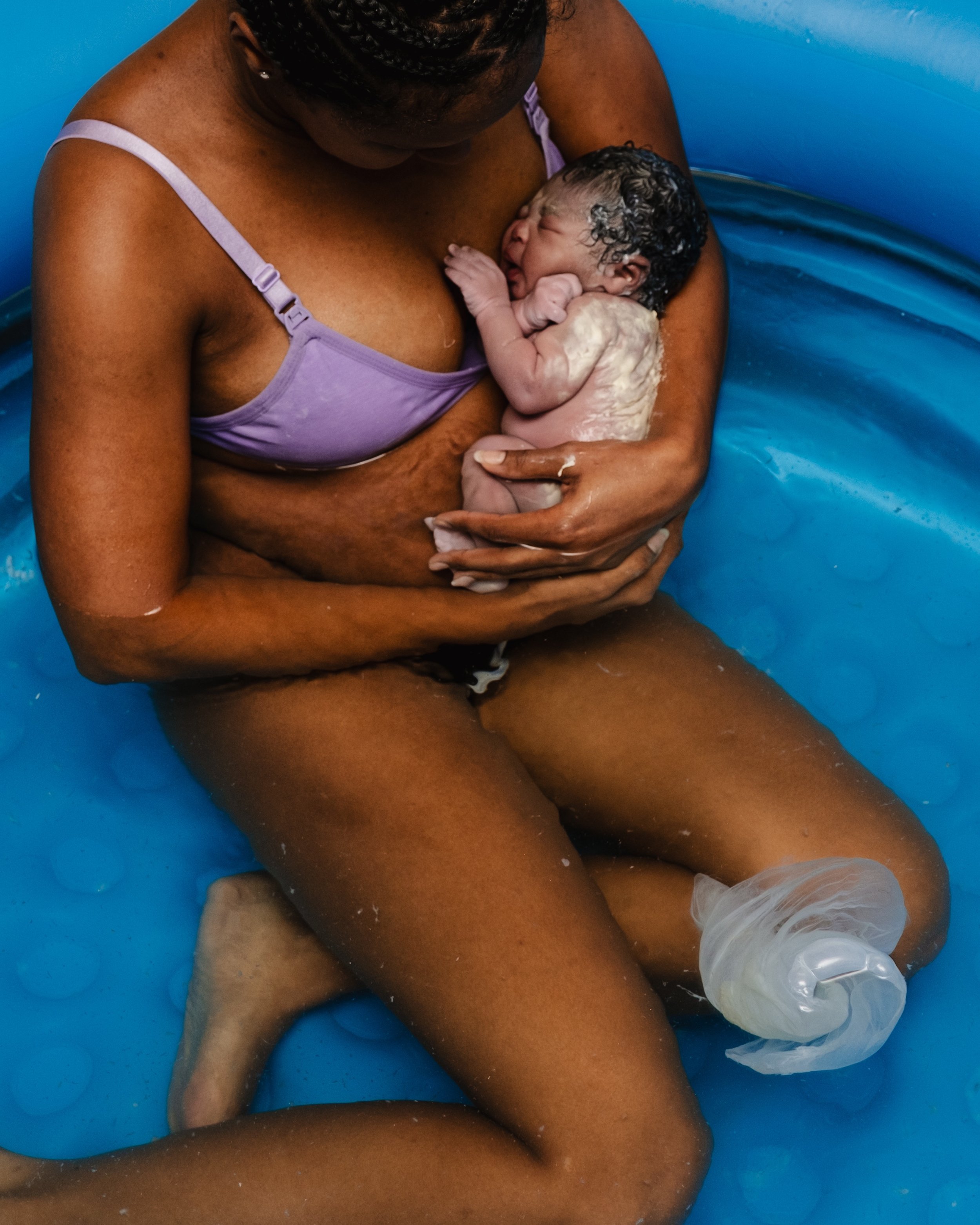 For a second, the membranes floating beside them looked almost like a little nautilus shell drifting through the birth pool. Which feels oddly fitting considering babies spend months growing in their own tiny underwater world before making their way 
