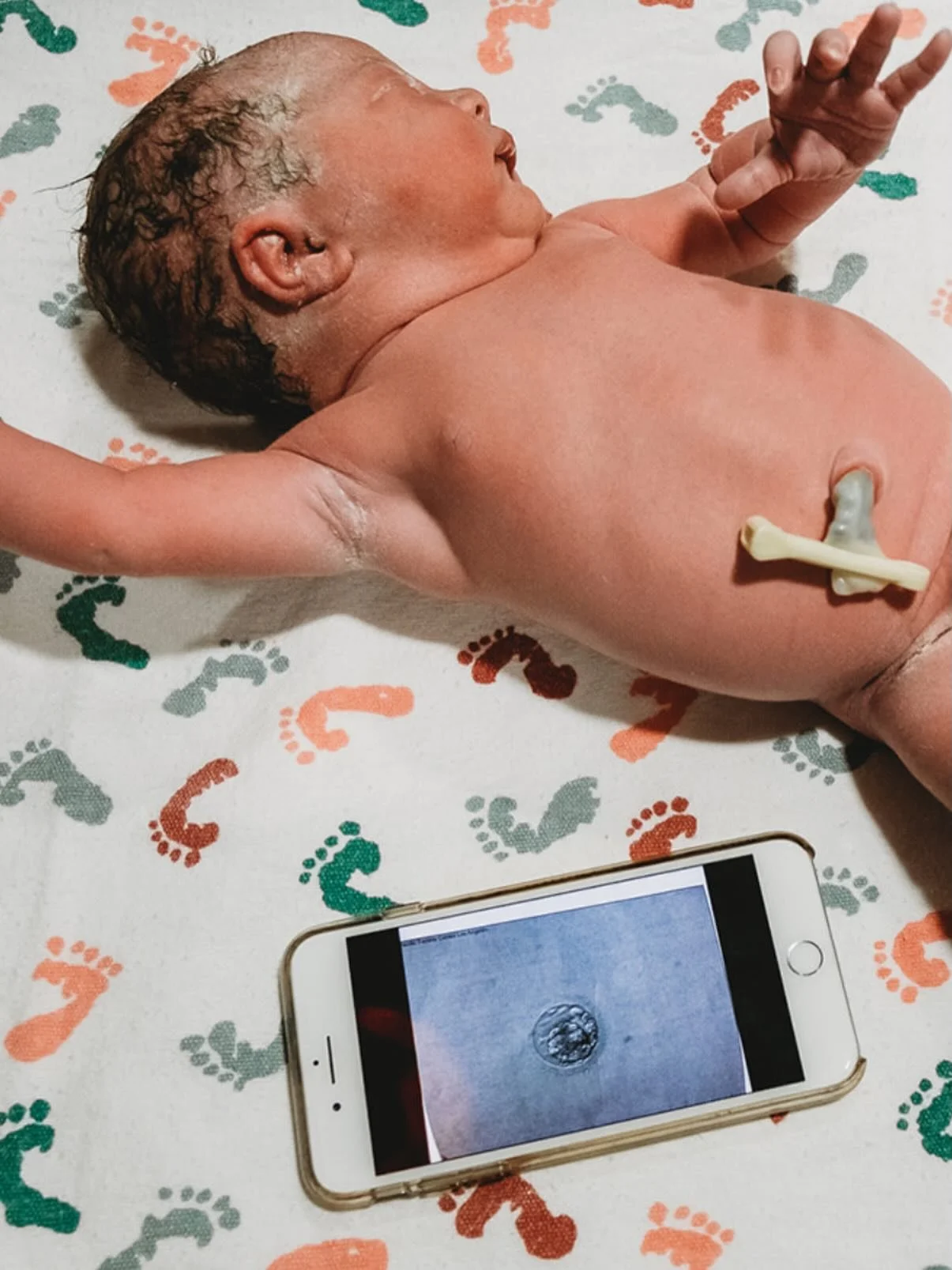 I have never experienced surrogacy or IVF myself. I can only imagine what it feels like to see your baby for the very first time as a cluster of cells on a screen, and dare to hope.

And yet. Look at her.

That tiny embryo on the phone &mdash; that i