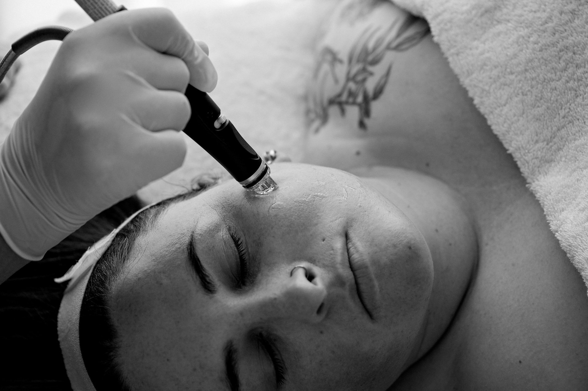 RefineTreatmentNov_207BW.jpeg