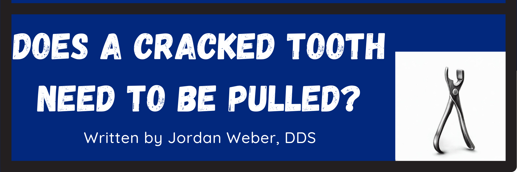 Does a Cracked Tooth Need to be Pulled? — Burlington Dental Center