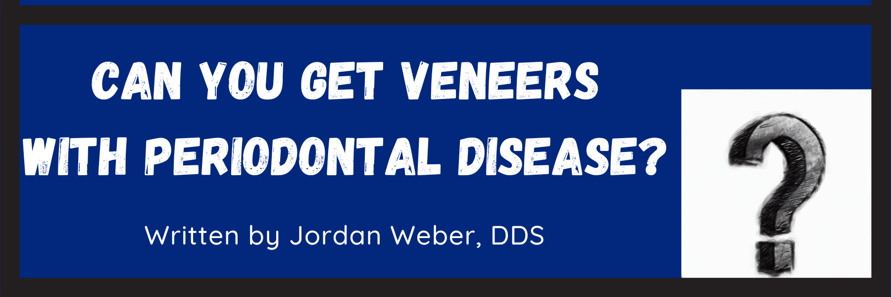 Lush Can You Get Veneers With Gum Disease Picture in HD Lush Can You Get Veneers With Gum Disease Picture in HD