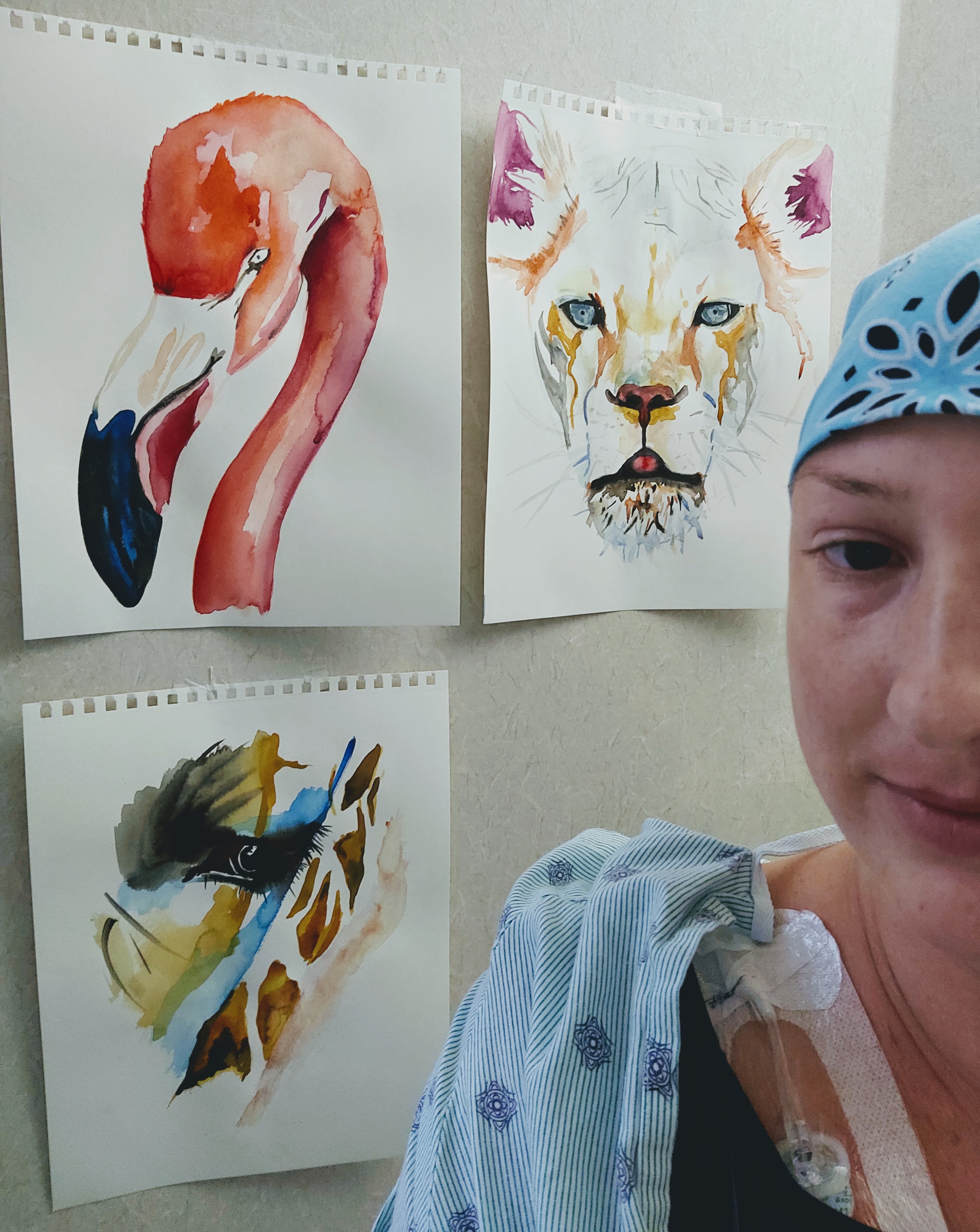 A woman in a hospital gown taking a selfie in front of three watercolor animal portraits on a wall: a flamingo, a lion, and a tiger.