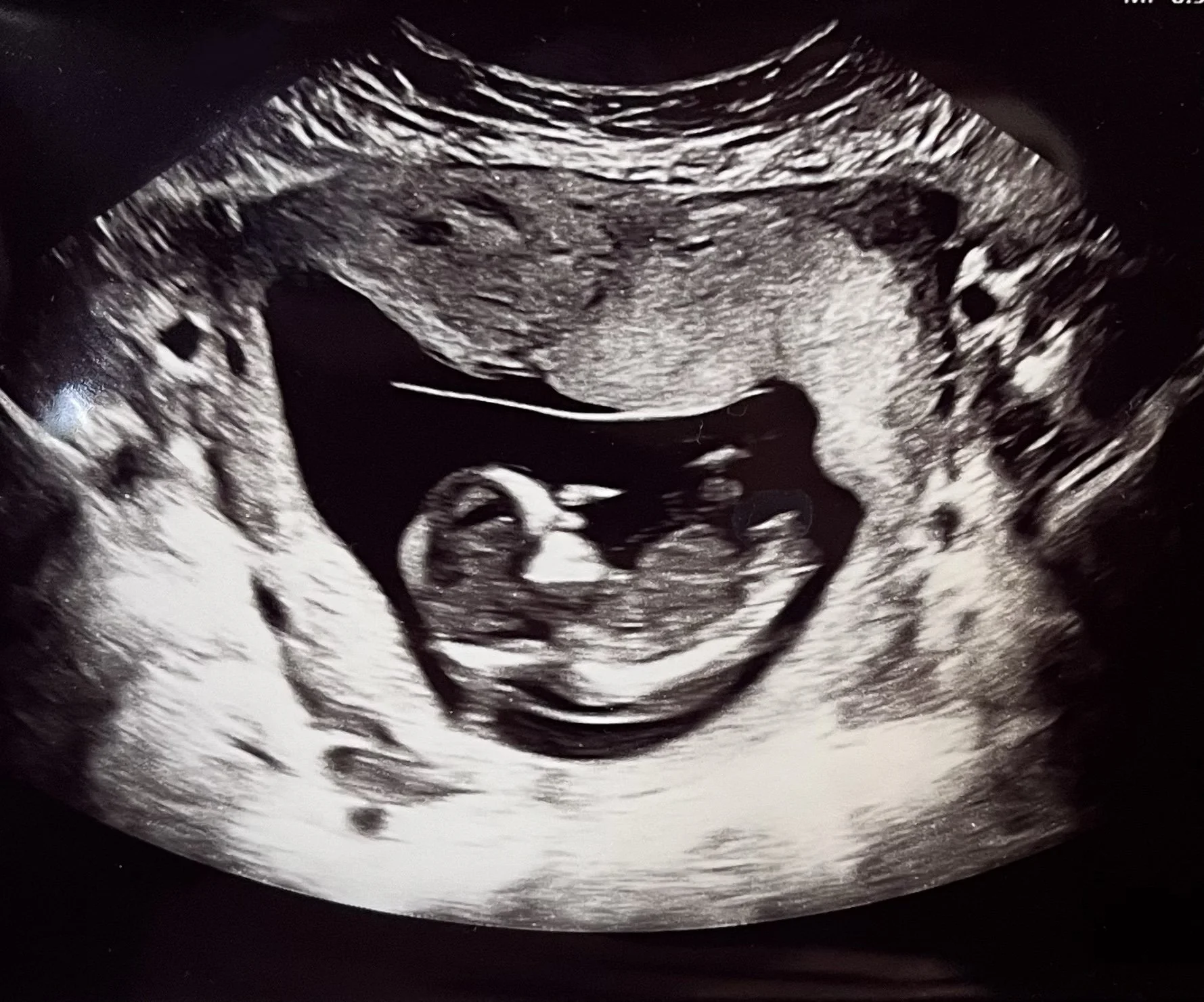 When Your Wife Says Her Womb Is A Tomb