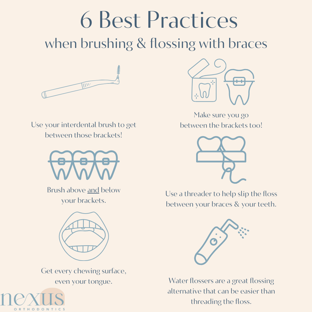 Best practices when brushing and flossing with braces by nexus orthodontics